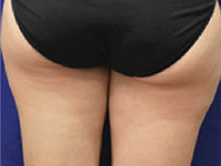 woman's backside butt